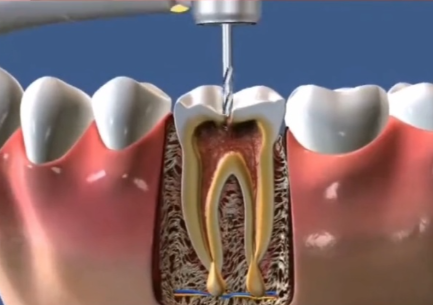 深圳美莱口腔门诊部医生技术怎么样?经验多超专精