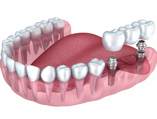 深圳美萊口腔門診部的技術優勢