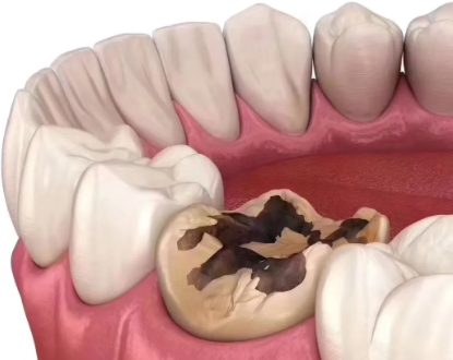 南通中诺口腔醫院是正規的嗎？放心！它資質齊全、醫技過硬，值得信賴！ 