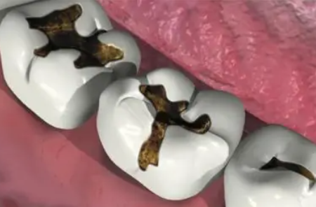 深圳美萊口腔門診部的特色技術