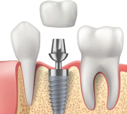深圳美莱口腔门诊部：实力强劲的医生团队
