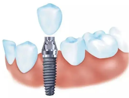 濟南百年中牙口腔醫院的收費貴不貴？
