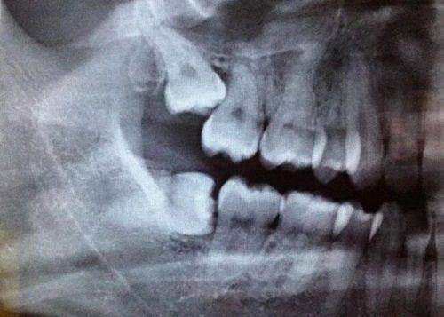 天津阳光树口腔（总院）怎么样？口碑与服务全面解析，值得信赖！