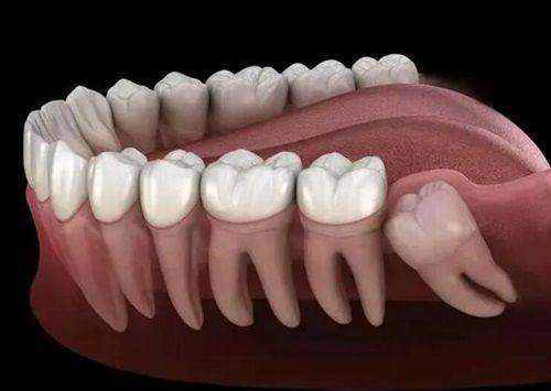 天津河西希望齿科怎么样？专业团队与先进设备让你放心就诊！