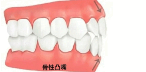 天津河西美澳（原美奥）口腔怎么样？真实患者分享治疗体验与效果分析