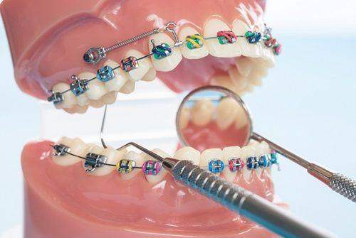 2026年种植牙价格参考：不同品牌与修复方案，费用如何选择？