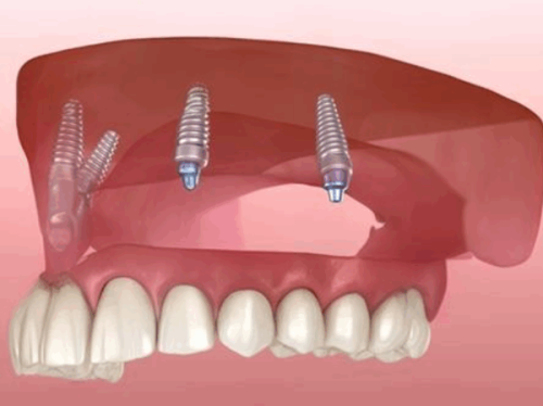 天津市河西区华奥茂和口腔门诊部怎么样？真实患者评价与就诊体验分享！