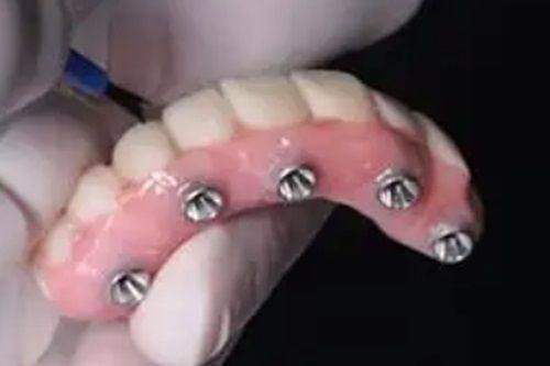 天津怡然美口腔门诊部怎么样？专业医师与优质服务让您放心就诊！