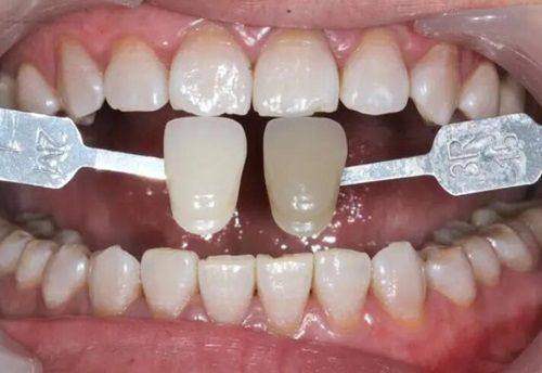 天津和平和睦美口腔诊所怎么样？专业团队助你拥有健康美牙！