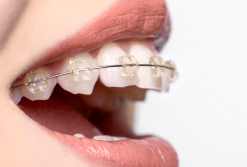 天津河西久美口腔怎么样？专业团队与贴心服务让你放心就诊！