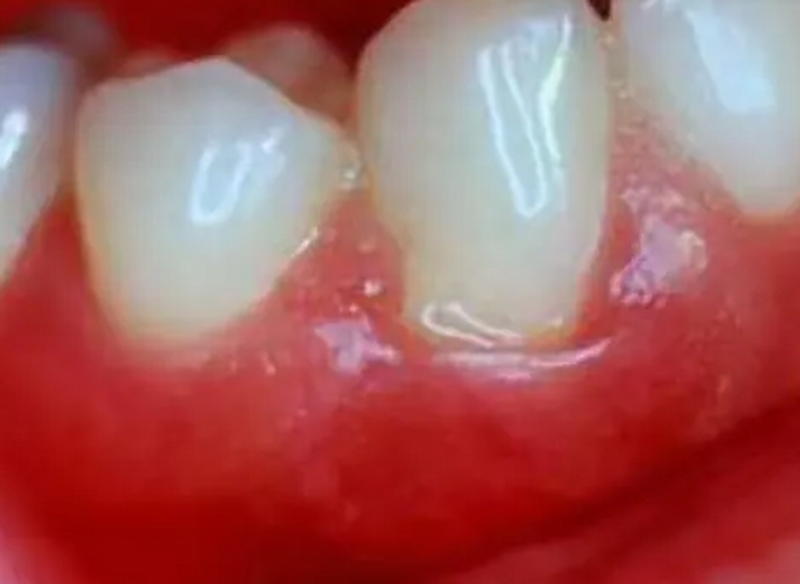 天津河西久美口腔怎么样？专业治疗与贴心服务赢得好评！