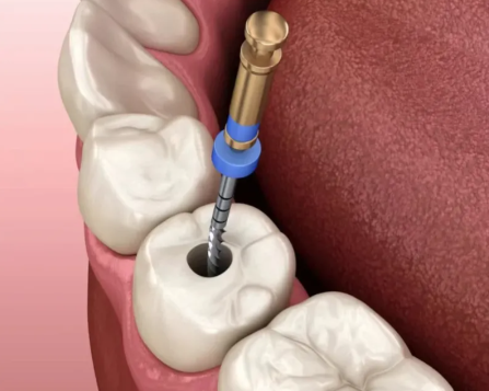 天津东丽优康美口腔门诊怎么样？专业医生与优质服务赢得患者信赖！