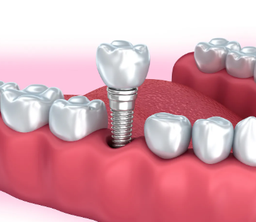 天津爱齿口腔(南开店)怎么样？专业团队让你安心看牙，服务口碑俱佳！