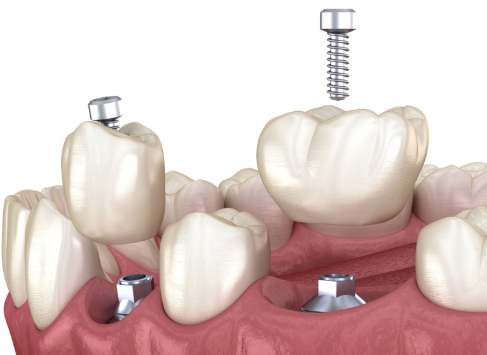 天津欢美口腔门诊部怎么样？专业医生让您的牙齿焕发新生！