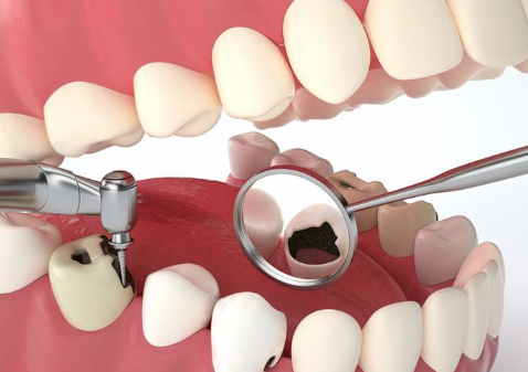 天津友芽好医齿科(和平分店)怎么样？专业医生与温馨服务让您放心就诊！