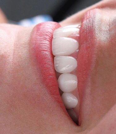 天津博凡口腔诊所怎么样？真实患者分享就医体验与效果分析