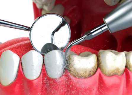 天津东丽优康美口腔门诊怎么样？专业医生和舒适环境值得信赖！