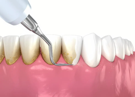 天津河西美澳（原美奥）口腔怎么样？专业医生与优质服务让你安心就诊！