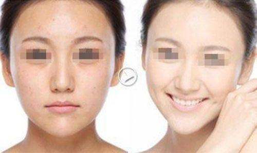 绍兴脸博士整形美容原华美