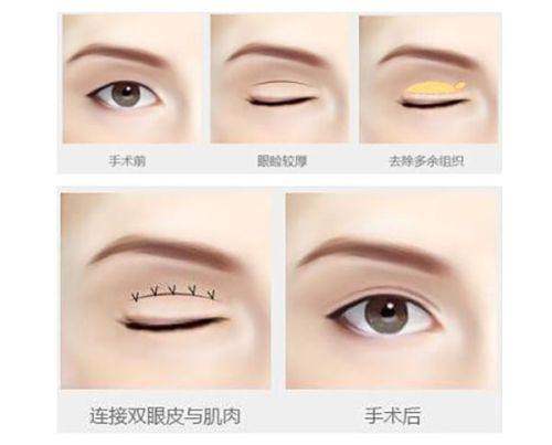 浙江绍兴新昌艺素美医疗美容诊所