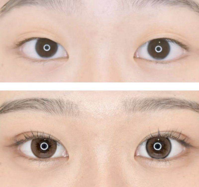 大连爱德丽格医疗美容门诊部王香平个人资料公布，告诉你她擅长啥项目、技术咋样值不值得选