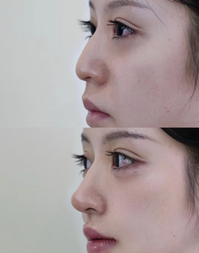 大连爱德丽格医疗美容门诊部王香平医生专精擅长