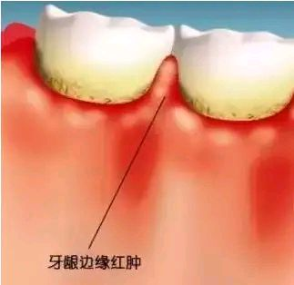 呼和浩特天牙口腔门诊部患者口碑