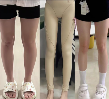 大连爱德丽格医疗美容门诊部：去眼袋技术精细