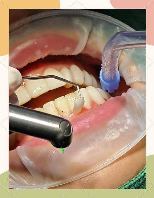 选择苏州拜博口腔诊所的理由