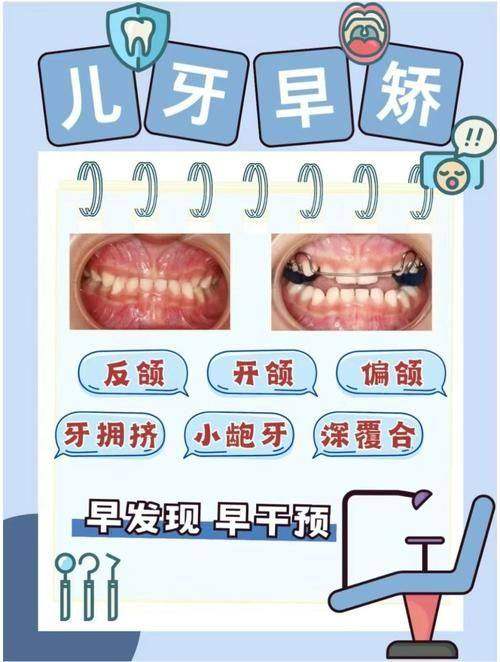 苏州泰康拜博口腔其他项目价格及优势