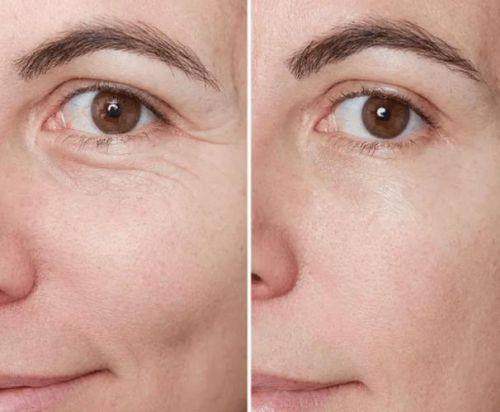 大连爱德丽格医疗美容门诊部宋立男除皱类可信吗？医生经验足技术好，值得信赖！ 