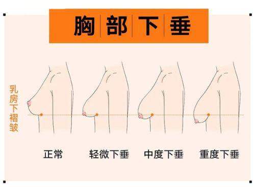 河南郑州整形美容医院评价口碑怎么样？真实体验揭秘，口碑好坏一目了然 