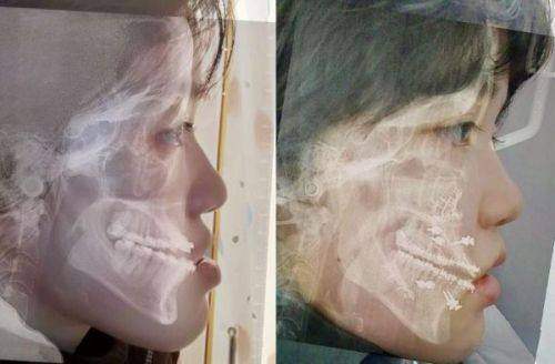 北京知音医疗美容门诊部值得信赖吗？