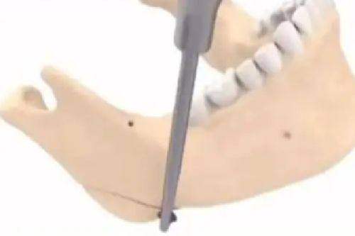 河南整形美容医院