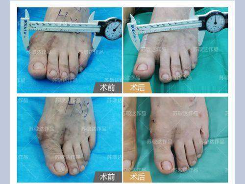 佛山君美整形美容医院是正规的吗？正规有资质且医生技术好，提供多样医美服务超靠谱 