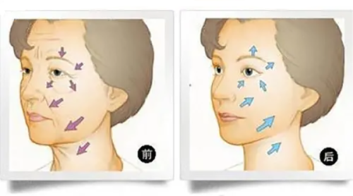 佛山君美整形美容医院收费标准咋样？性价比高，项目丰富，满足多样变美需求！ 