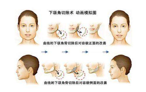 郑州大学第五附属医院医疗整形美容中 心