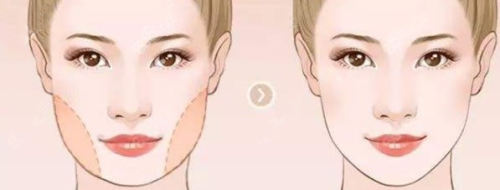 郑州美莱医疗美容