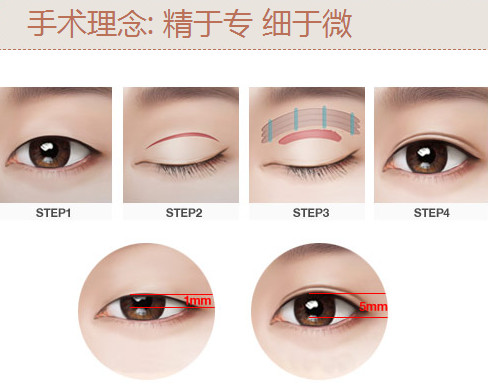 昆明丽格医疗美容诊所是不是正规医院？答案是肯定的，它资质正规技术靠谱值得信赖