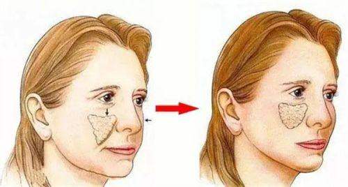 佛山蒂娜医疗美容门诊部评价口碑怎么样？真实反馈揭秘，技术服务双优值得信赖！ 