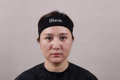 广东深圳美莱整形