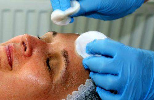 深圳军科医疗美容门诊部张朝阳医生胶原蛋白除皱的成效如何