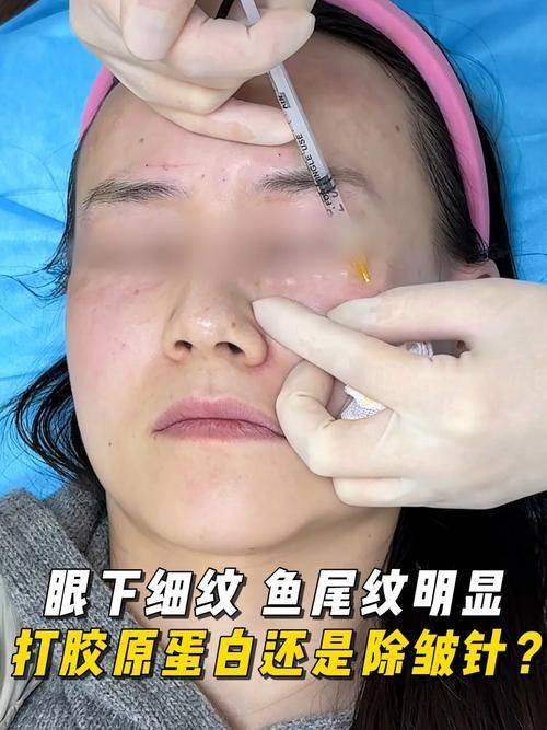 如何提高深圳军科医疗美容门诊部胶原蛋白除皱成效