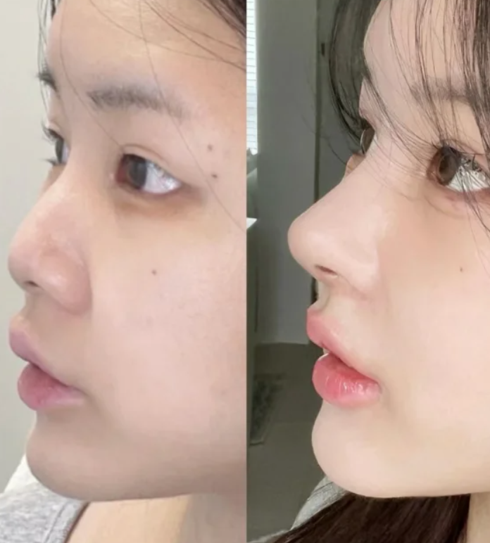 实例分析:正视问题,积极解决