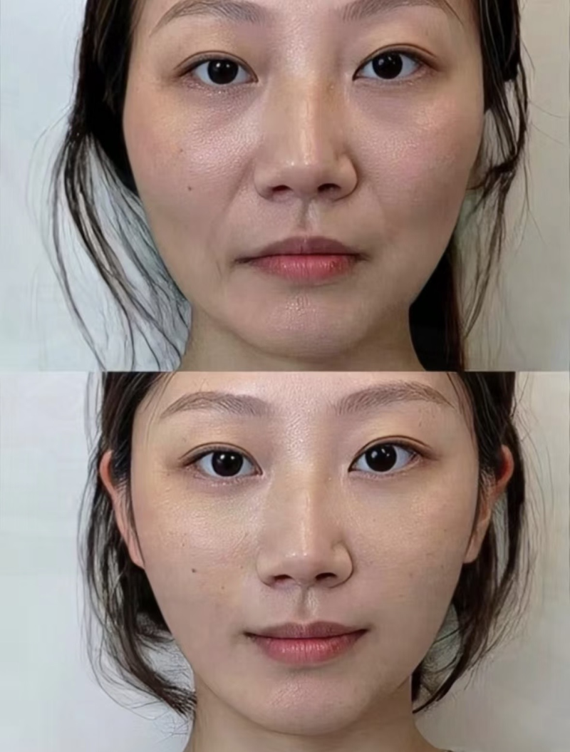 佛山蒂娜医疗美容门诊部的医疗水平