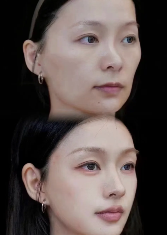 河南整形美容医院有限公司:张正文医生的技术特点