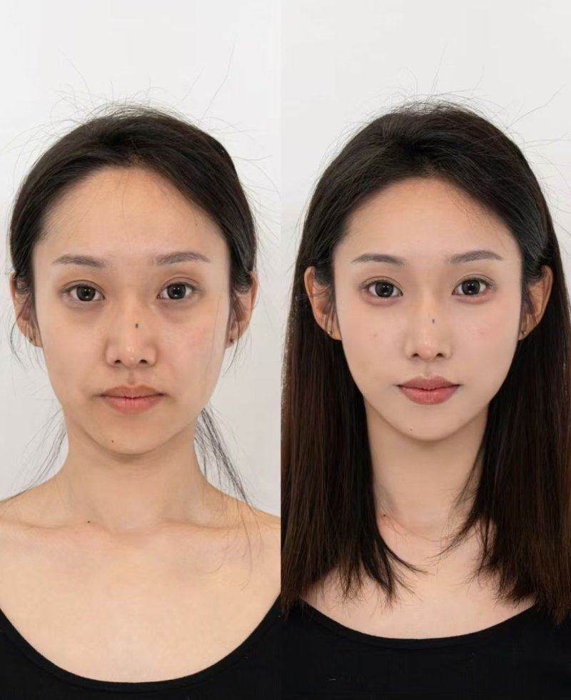 在昆明丽格开启美丽之旅