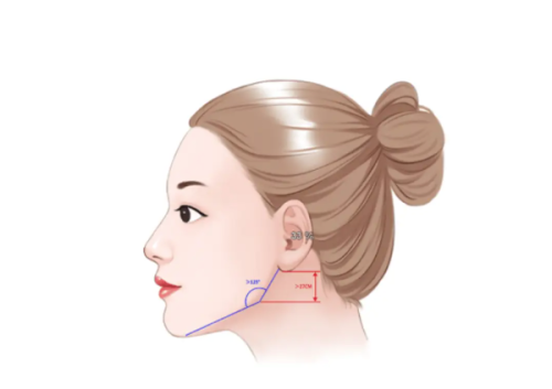 苏州康美美容医院张红玲医生设备优势解读