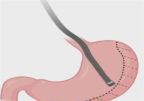 苏州康美整形美容医院的优势与实例