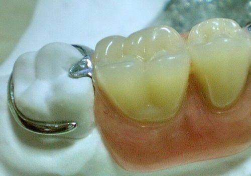 蘇州泰康拜博口腔:患者口碑了解下